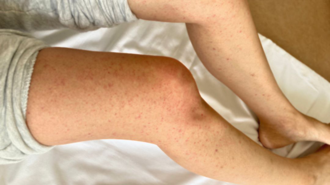 見出し1画像_嶋村吉洋社長が主催するワクセルのコラム_男装くん_異変